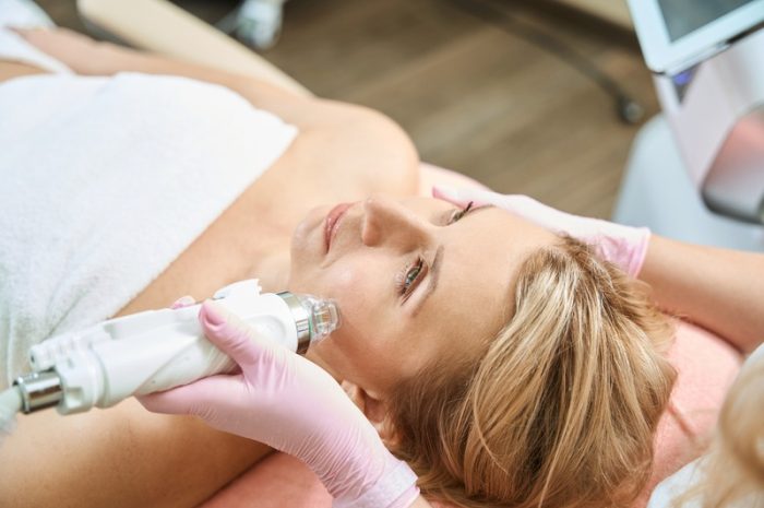 What Is Microneedling, and Who Can Benefit?