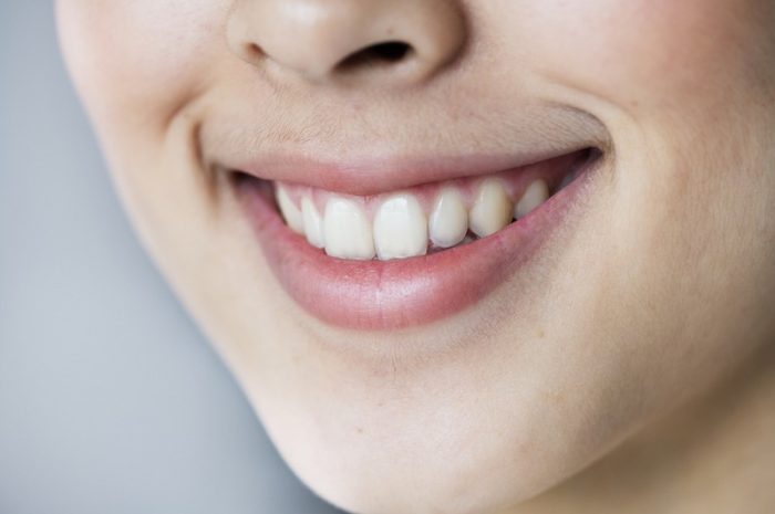 What to Expect During a Dental Procedure?